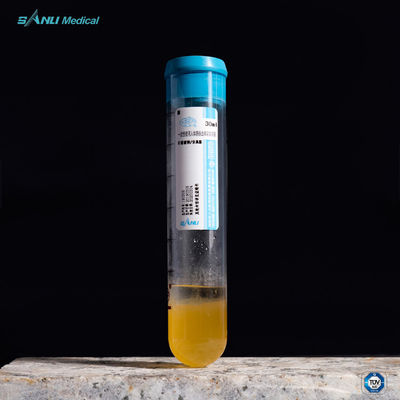 Entlasten Sie Reagenzglas 20ml ACD-A der Schmerz-PRP mit GEL für OA-Behandlung