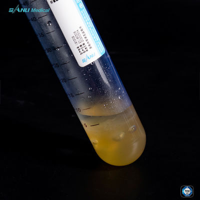 Verringern Sie Entzündungs-Plättchen Rich Plasma Tube STREICHELN 50ml für OA-Behandlung