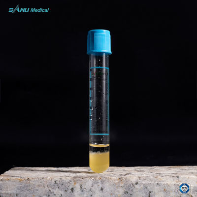Reagenzglas Plättchen-Rich Plasmas PRP 10ML mit Gel des Natriumcitrat-3,2%